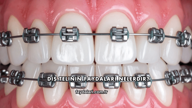 Diş Telinin Faydaları Nelerdir?