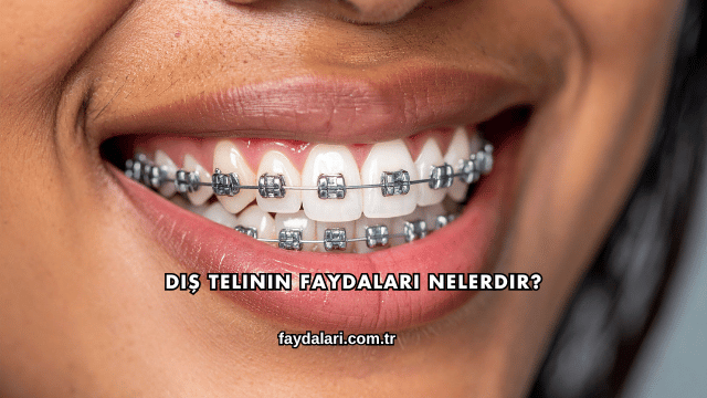 Diş Telinin Faydaları Nelerdir?