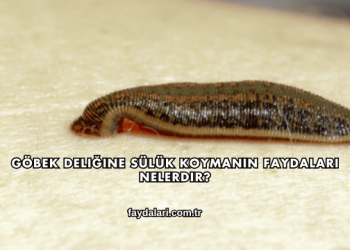 Göbek Deliğine Sülük Koymanın Faydaları Nelerdir?
