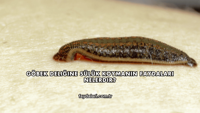 Göbek Deliğine Sülük Koymanın Faydaları Nelerdir?
