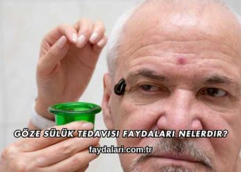 Göze Sülük Tedavisi Faydaları Nelerdir?