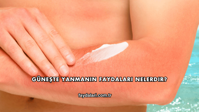 Güneşte Yanmanın Faydaları Nelerdir?