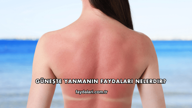 Güneşte Yanmanın Faydaları Nelerdir?