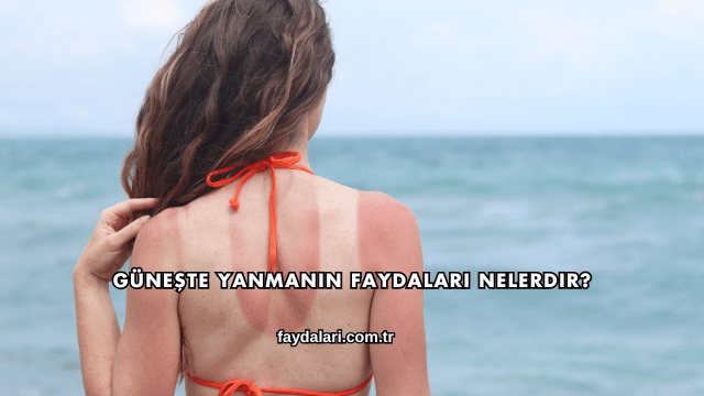 Güneşte Yanmanın Faydaları Nelerdir?