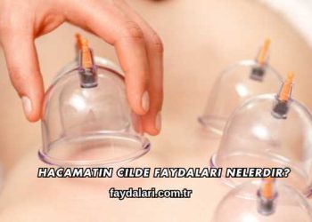 Hacamatın Cilde Faydaları Nelerdir?