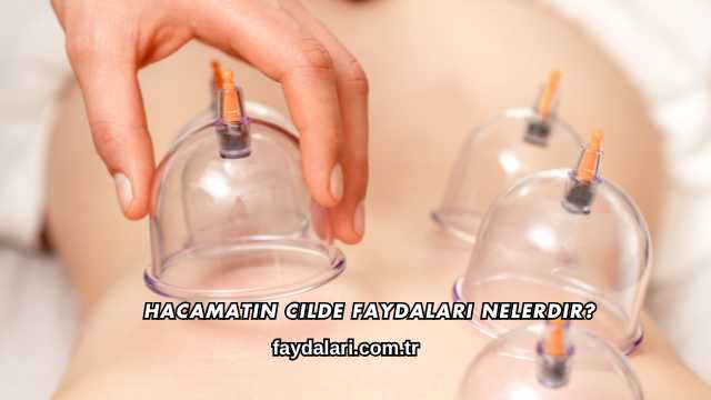 Hacamatın Cilde Faydaları Nelerdir?