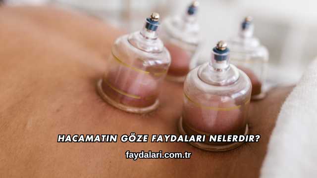 Hacamatın Göze Faydaları Nelerdir?