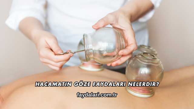Hacamatın Göze Faydaları Nelerdir?