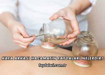 Kafa Arkası Hacamatın Faydaları Nelerdir?
