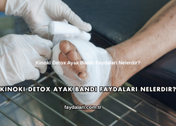 Kinoki Detox Ayak Bandı Faydaları Nelerdir?