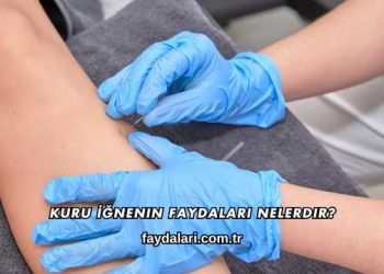 Kuru İğnenin Faydaları Nelerdir?