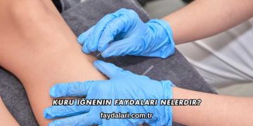 Kuru İğnenin Faydaları Nelerdir?