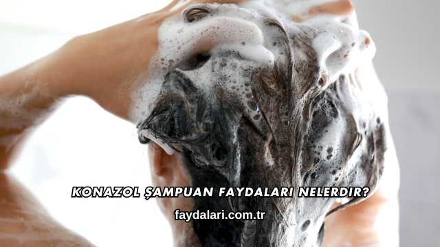 Konazol Şampuan Faydaları Nelerdir