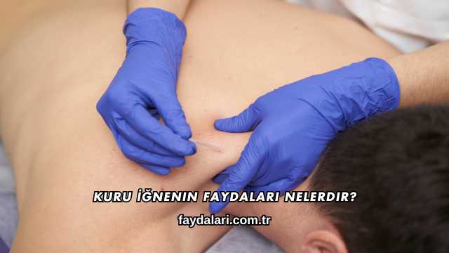 Kuru İğnenin Faydaları Nelerdir?