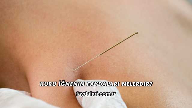 Kuru İğnenin Faydaları Nelerdir?