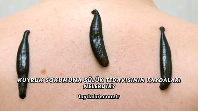 Kuyruk Sokumuna Sülük Tedavisinin Faydaları Nelerdir?