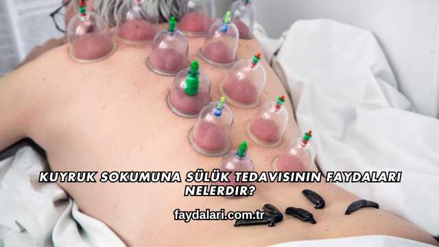 Kuyruk Sokumuna Sülük Tedavisinin Faydaları Nelerdir?