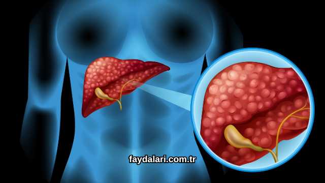 Ligone Milk Thistle Complex Faydaları Nelerdir?