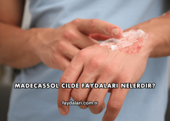 Madecassol Cilde Faydaları Nelerdir?