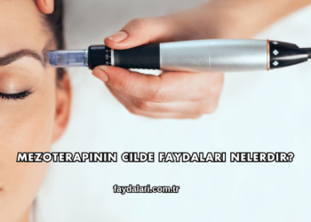 Mezoterapinin Cilde Faydaları Nelerdir?