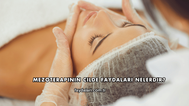 Mezoterapinin Cilde Faydaları Nelerdir?