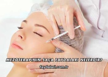 Mezoterapinin Saça Faydaları Nelerdir?