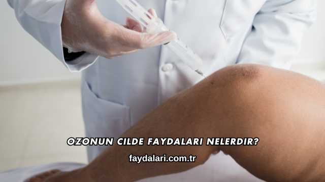 Ozonun Cilde Faydaları Nelerdir?