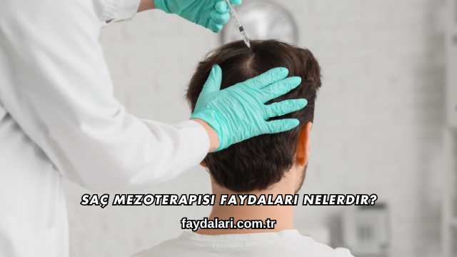 Saç Mezoterapisi Faydaları Nelerdir?