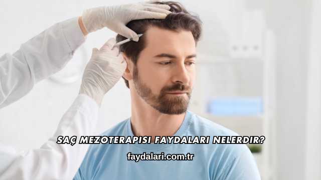 Saç Mezoterapisi Faydaları Nelerdir?