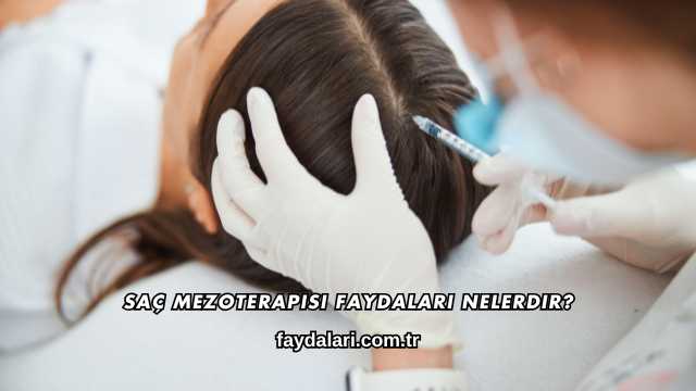 Saç Mezoterapisi Faydaları Nelerdir?