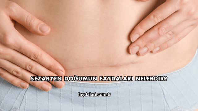 Sezaryen Doğumun Faydaları Nelerdir?