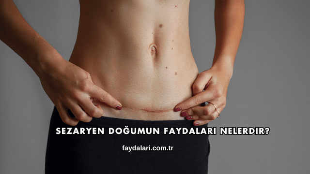 Sezaryen Doğumun Faydaları Nelerdir?