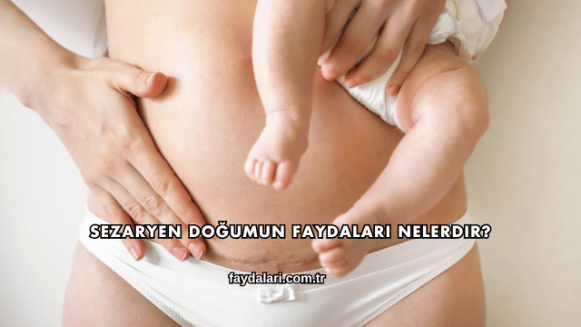 Sezaryen Doğumun Faydaları Nelerdir?