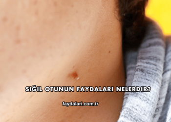 Siğil Otunun Faydaları Nelerdir?
