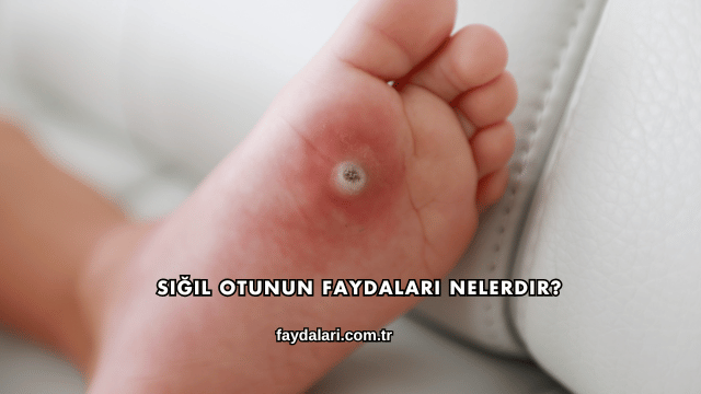 Siğil Otunun Faydaları Nelerdir?