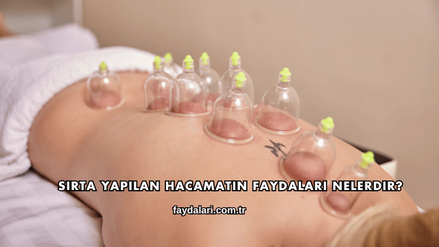 Sırta Yapılan Hacamatın Faydaları Nelerdir?