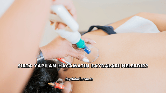Sırta Yapılan Hacamatın Faydaları Nelerdir?