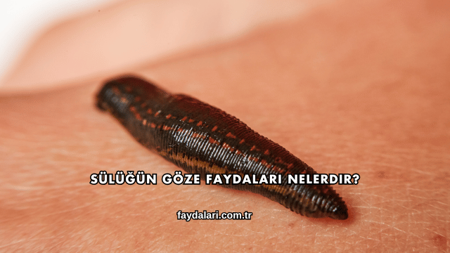 Sülüğün Göze Faydaları Nelerdir?