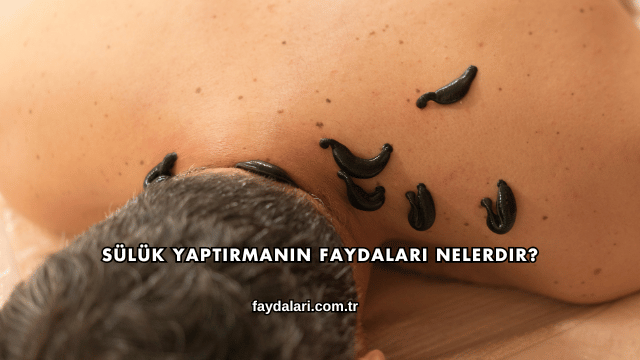 Sülük Yaptırmanın Faydaları Nelerdir?