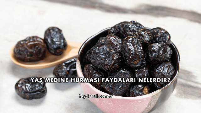 Yaş Medine Hurması Faydaları Nelerdir?