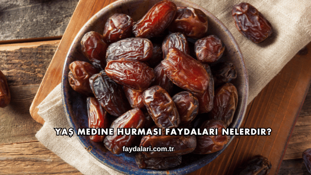 Yaş Medine Hurması Faydaları Nelerdir?