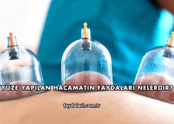 Yüze Yapılan Hacamatın Faydaları Nelerdir?